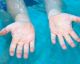 Sai perché la pelle dei polpastrelli si raggrinzisce quando stai tanto in acqua?