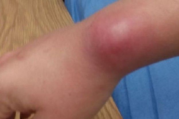 QUESTO PROBLEMA AL POLSO pu&ograve; ESSERE CAUSATO da UNA COSA CHE FAI TUTTI I GIORNI!