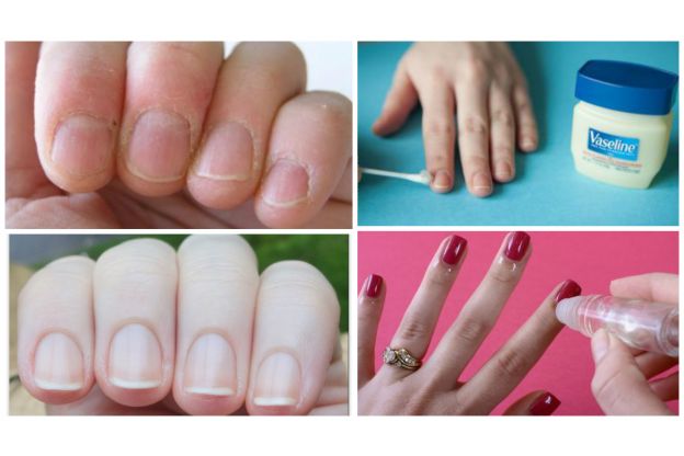 COME SMETTERE DI AVERE LE PELLICINE DELLE DITA SCREPOLATE?