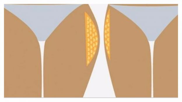 gli esercizi per i fianchi...una questione ben pi&ugrave; che solo estetica