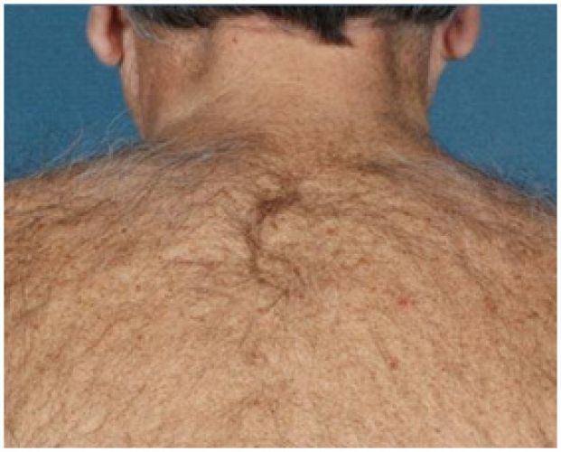 Rimuovi i peli superflui