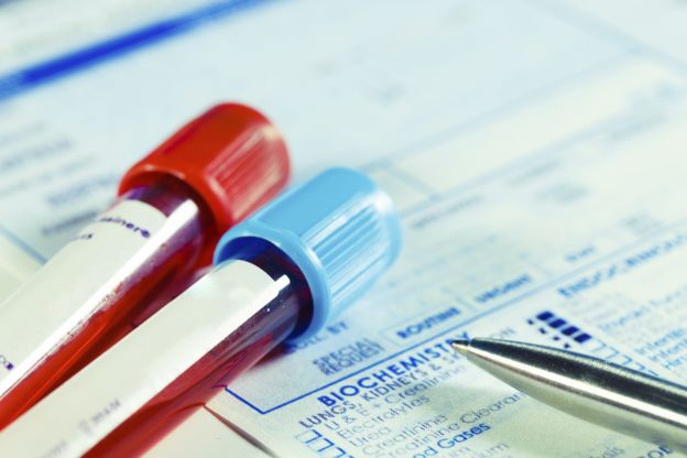 I trucchi per perdere peso senza smettere di mangiare