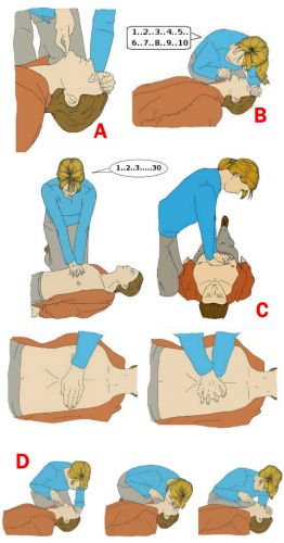 Rianimazione cardiopolmonare