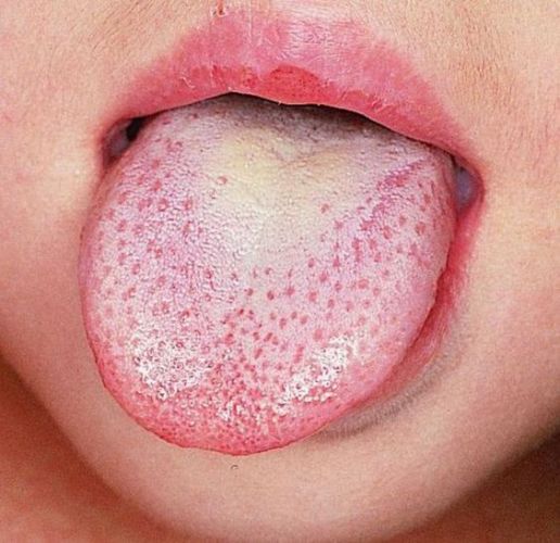 Spazzolate la lingua