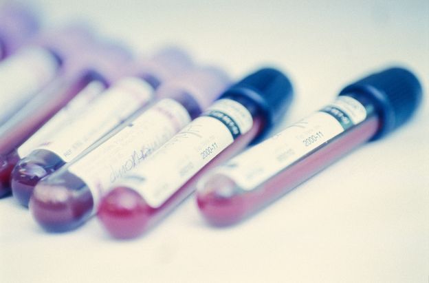 Abbassa i livelli di zucchero