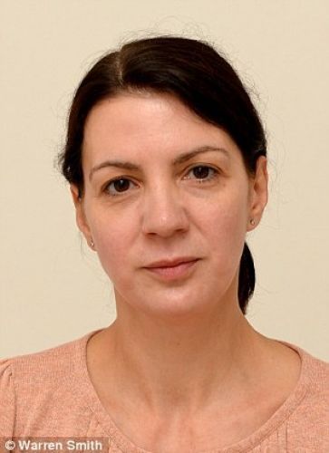 Dopo la seconda settimana il viso di Sarah è così: