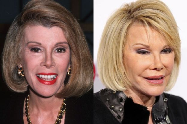 Joan Rivers