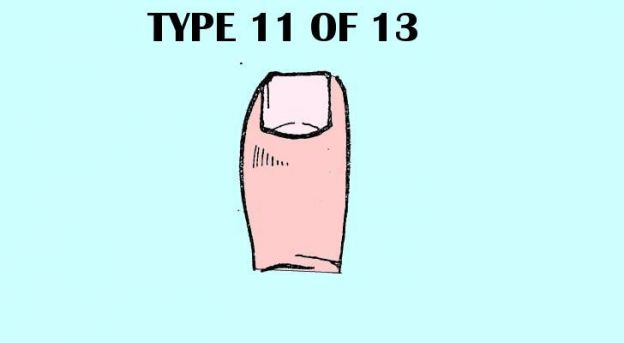 Quadrata ed irregolare